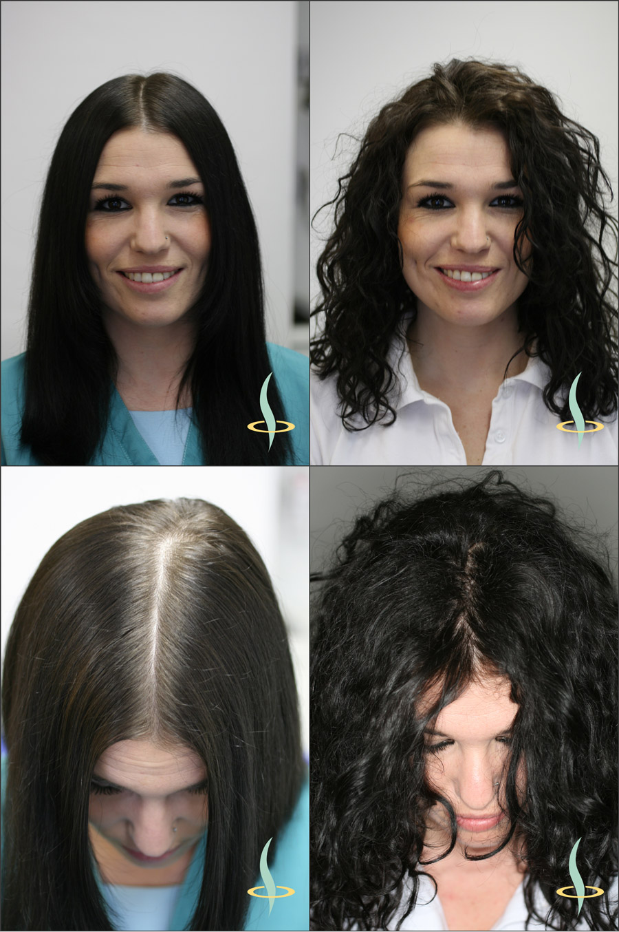 Resim 2: Düz (sol) ve dalgalı (sağ) saçların kafa derisinin görülmesi üzerindeki görsel etkisi. (Kaynak: Kendi görselimiz)